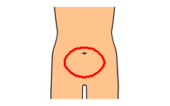 下腹部全体の痛み(女性特有の病気)
